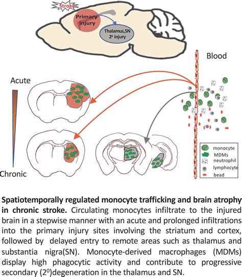 Delayed Infiltration Of Peripheral Monocyte Contributes To Phagocytosis