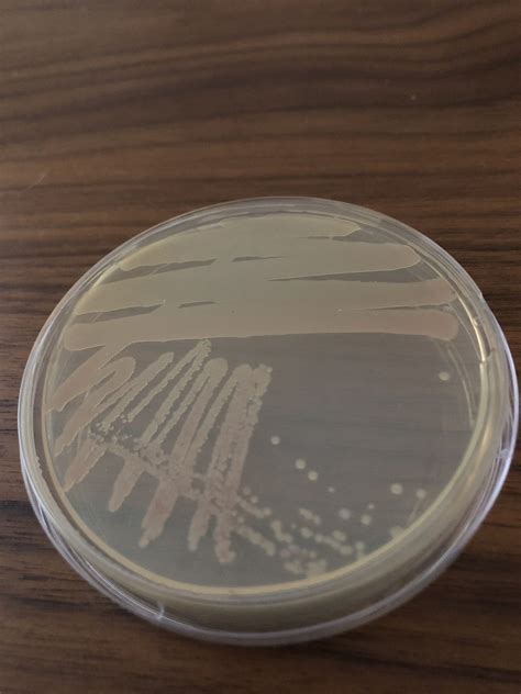 STREAK PLATE Hands On Microbiology