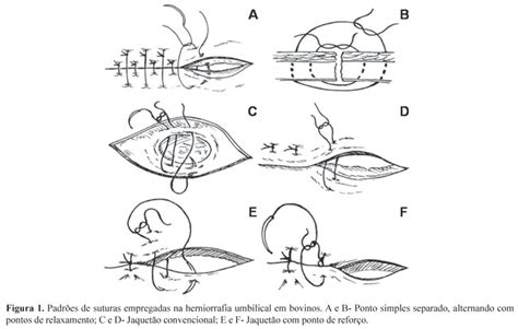 Scielo Brasil Tratamento De H Rnia Umbilical Em Bovinos Tratamento De