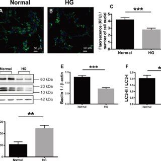 The Effects Of High Glucose On Autophagy And Apoptosis Of Retinal