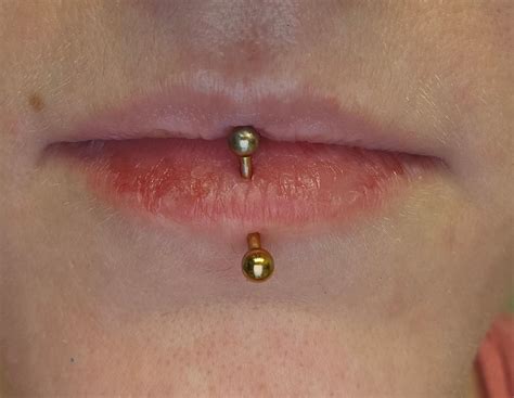 15 Year Old Vertical Labret How Long Do You Think It Would Take To Close Up Rpiercing