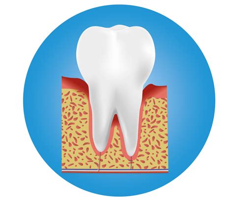 Inflammation Of The Gums Detecting And Treating Gingivitis Bioniq