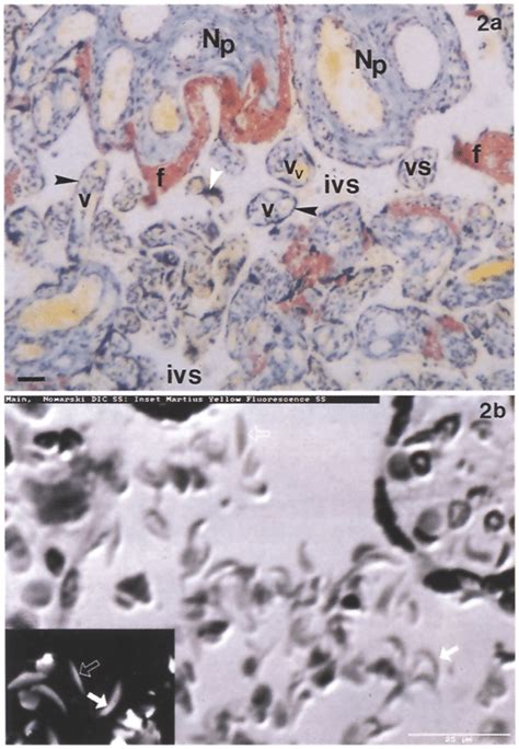 A A Micrograph Of Placental Tissue Stained By The MSB Method In Which