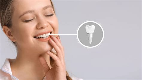 Transform Your Smile With Dental Implants Winning Smiles Dental Surgery