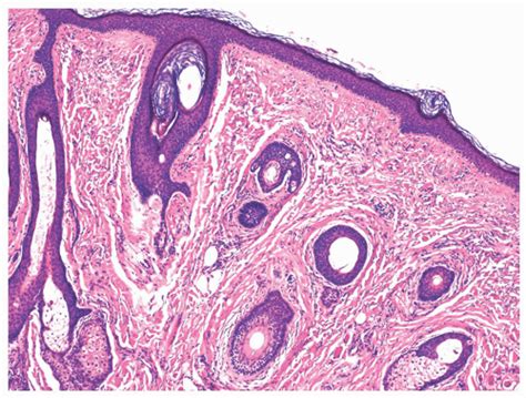 Normal Anatomy and Histology | Basicmedical Key