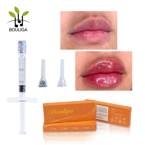 Biphasic Monophasic Ha Crosslinked Hyaluronic Acid Filler Injectable Facial