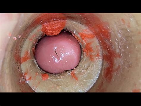 Camera Inside Deep Pussy Captures Big Dose Ejaculation Of Sperm ASMR XVIDEOS