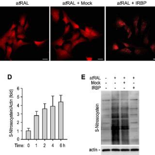 Interphotoreceptor Retinoid Binding Protein Attenuated TNF Activation