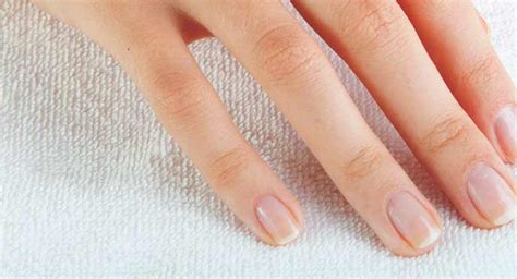 Fungal Nail Infection: Overview, Causes & Treatments