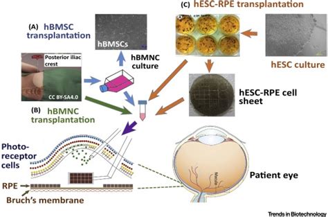 Stem Cell Therapies For Reversing Vision Loss Trends In Biotechnology