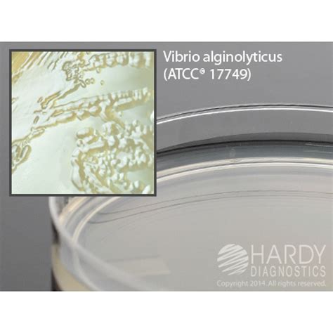 Hardy Diagnostic G226 Dry Culture Media Marine Agar Plate 90 Day