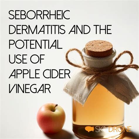 Seborrheic Dermatitis And The Potential Use Of Apple Cider Vinegar Skindrone