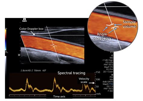 Spectral Doppler 123sonography