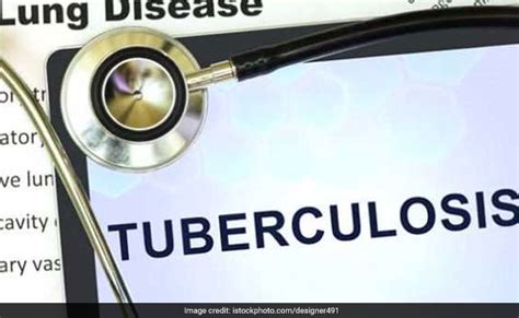 Tuberculosis Treatment: 8 Foods That Can Help You Recover Faster