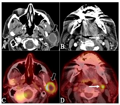 Johbm Free Full Text Beyond Ultrasound Multimodal Cross Sectional Imaging For Preoperative