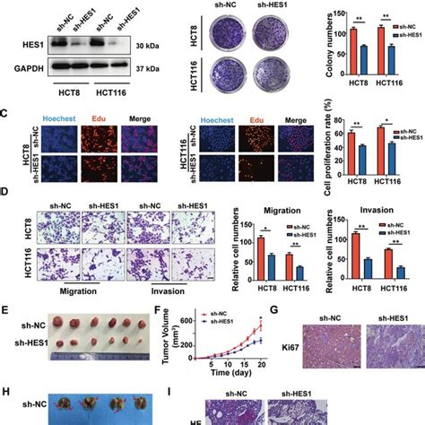 Knockdown Of HES1 Inhibits The Malignant Behavior Of CRC Cells Invitro