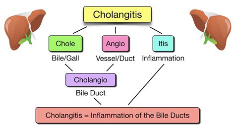 Choledocholithiasis Vs Cholelithiasis