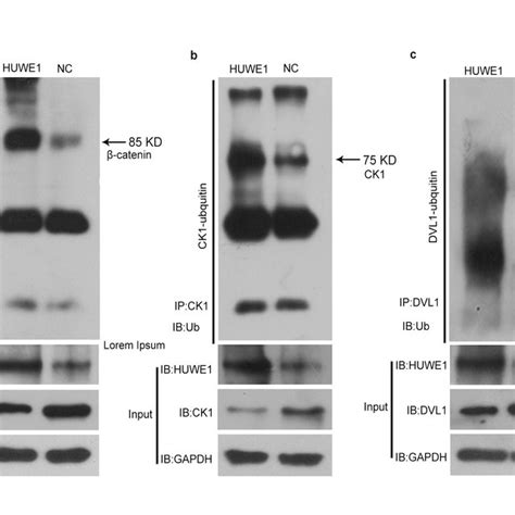 Immunohistochemical Analysis Of Rod And Cone Photoreceptors In