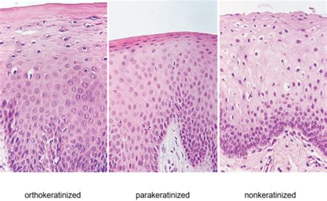 GRISTO Oral Mucosa Glands Tongue Oral Cavity Palate And Pharynx