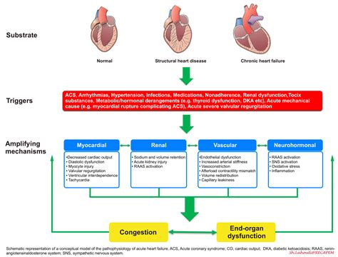 Sympathetic Crashing Acute Pulmonary Edema (SCAPE): Insight, 41% OFF