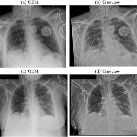 Examples Of Postprocessed Enhanced Oem And Trueview Images A B 26