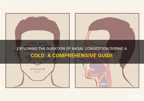 Exploring The Duration Of Nasal Congestion During A Cold: A ...