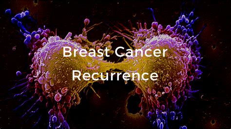 Breast Cancer Recurrence: The Breast Cancer School fro Patients