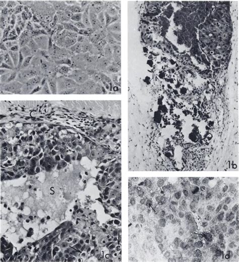 Figure From Tumorigenicity In Nude Mice Of A Human Hepatoma Cell Line