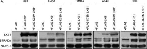 STE20 related Kinase Adaptor Protein α STRADα Regulates Cell Polarity