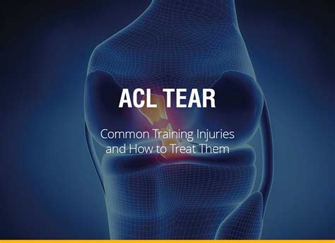 Common Training Injuries and How To Treat Them - ACL Tear - Fight Quality