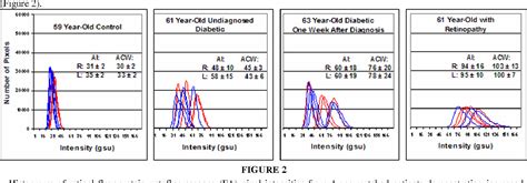 Figure 1 From Retinal Flavoprotein Autofluorescence As A Measure Of