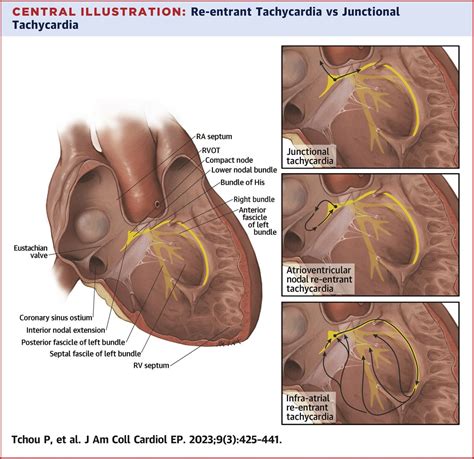 JACC Journals On Twitter JACCCEP Review Suggests Much Of What S Been