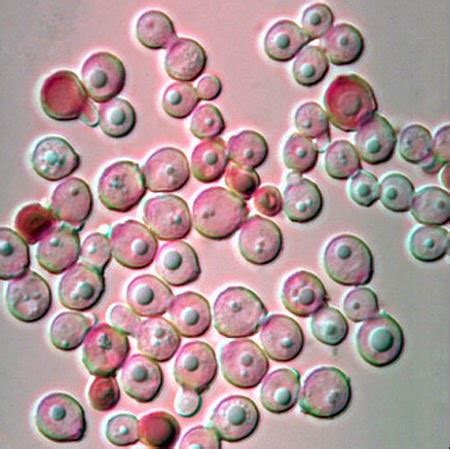 Medical Laboratory and Biomedical Science: Malassezia Yeast Infections