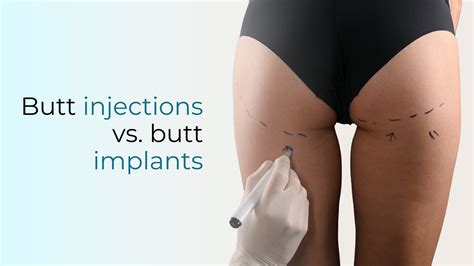 Butt Injections Vs Butt Implants Face Forward Aesthetics