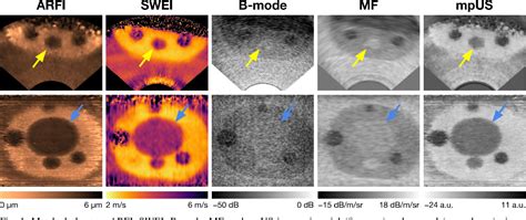 Figure 1 From Evaluating Image Quality Improvement In Multiparametric