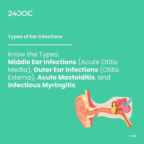 Ppt Navigating Ear Infections Understanding Treating And Preventing