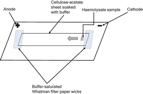 Cellulose Acetate Electrophoresis: Principle and Application • Microbe ...