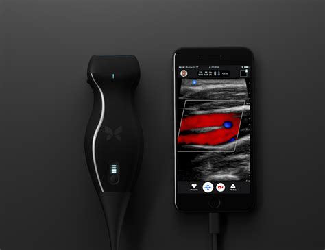 Butterfly iQ Portable Ultrasound Device » Gadget Flow