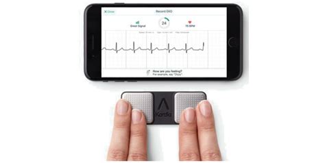 Recording of an electrocardiogram (ECG) with the KardiaMobile Device ...