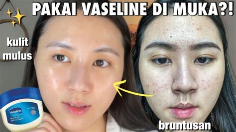 Cobain Teknik Skincare Viral Dari Tiktok ‘slugging Di Kulit Berjerawat