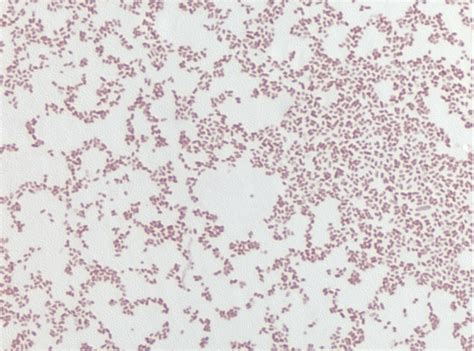 Klebsiella Aerogenes Gram Stain