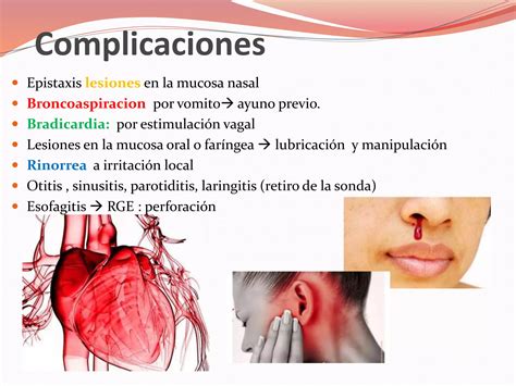 La Sonda Nasogastrica PPT Descarga Gratuita