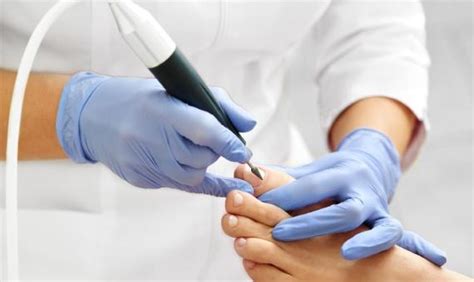 Medical Pedicure In Chicago Suburbs Treatment And Costs