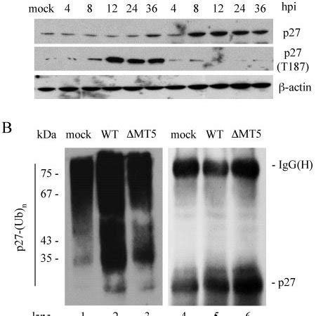 Expression Of M T Promotes Ubiquitination And Degradation Of P Kip