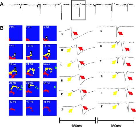 Mechanisms Of Vf Maintenance Wandering Wavelets Mother Rotors Or