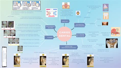 Mapa Conceptual Sobre Caries Dental Porn Sex Picture