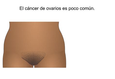 PatEdu Cáncer de ovarios