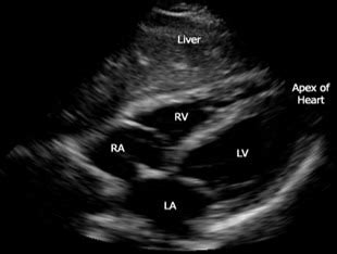 Vascular Cardiac Medical Imaging Flashcards Quizlet