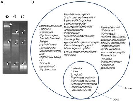 Dgge Analysis Of Selected Samples Panel A Shows Representative Pcr Download Scientific Diagram