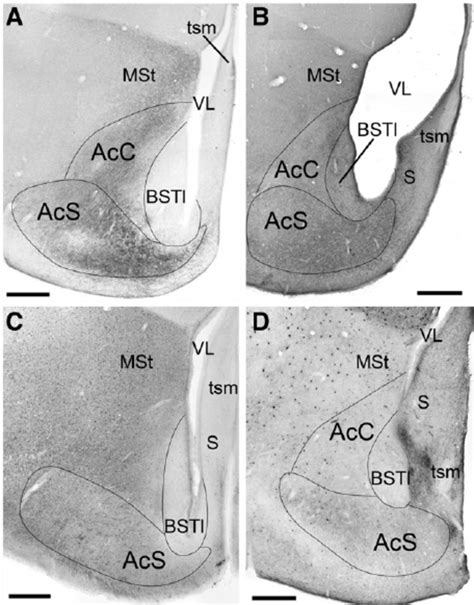 Transverse Sections Of Chick Brain Showing Nucleus Accumbens Ac